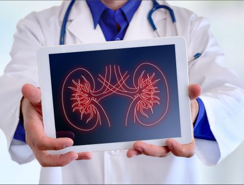 El riñón como principal órgano encargado de eliminar medicamentos del cuerpo