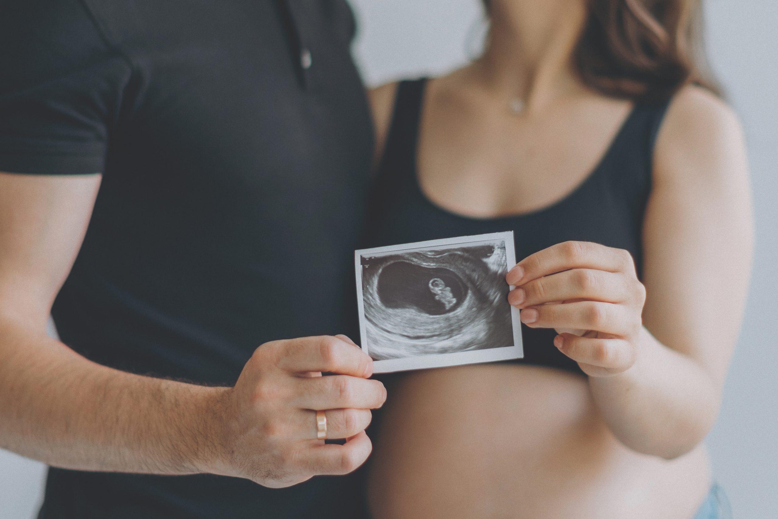 ecografías-embarazo