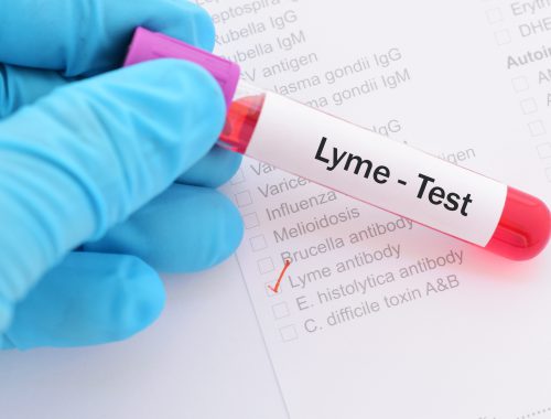 lyme-tratamiento