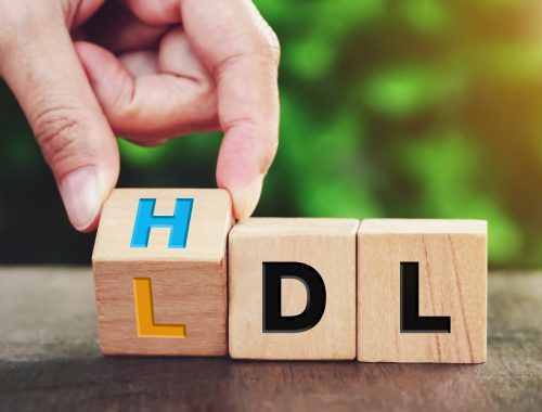 colesterol-alto-HDL-LDL