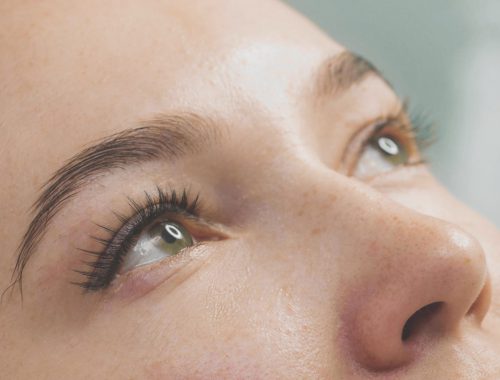 trasplante-cejas-foliculo_BLOGHLA