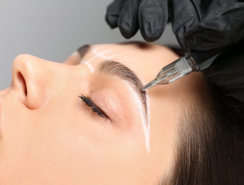 micropigmentación-cáncer-estética