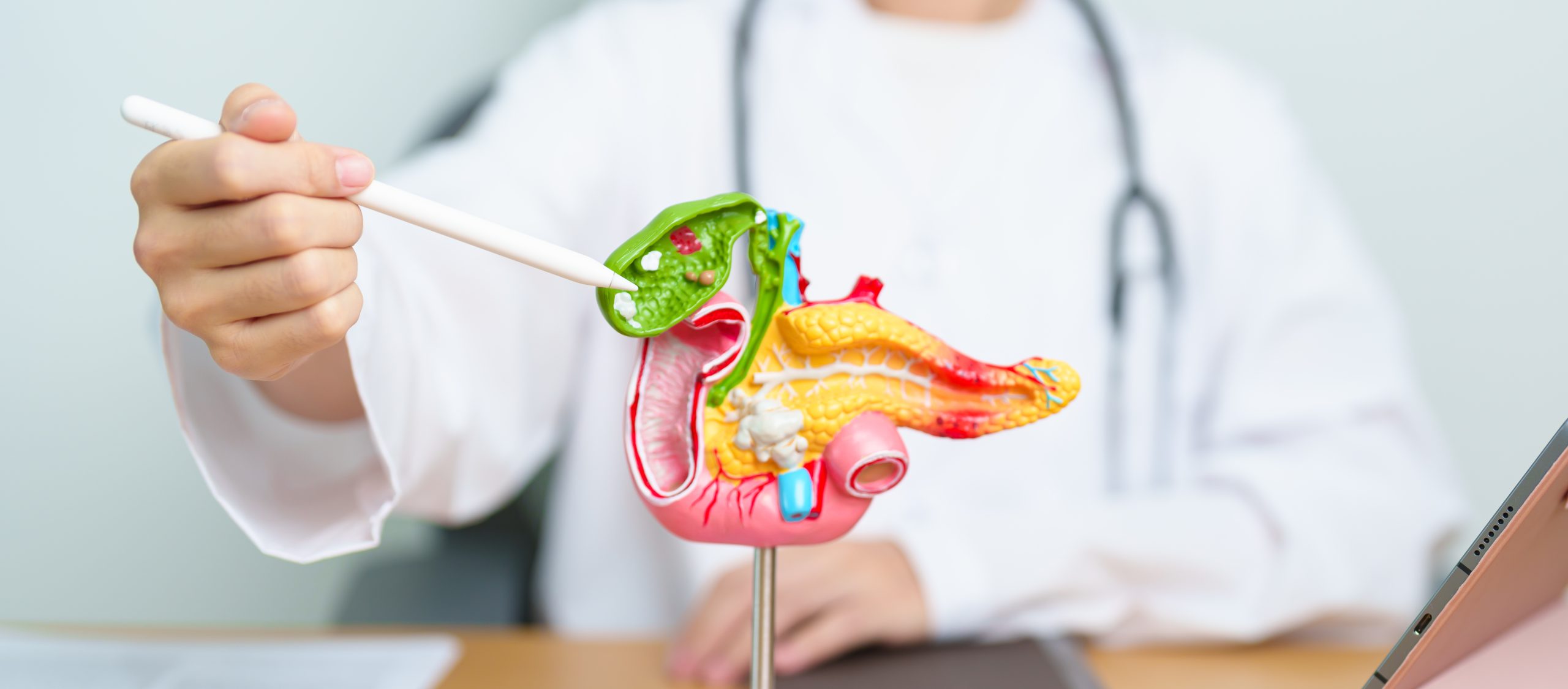 colangiocarcinoma-cancer-biliar