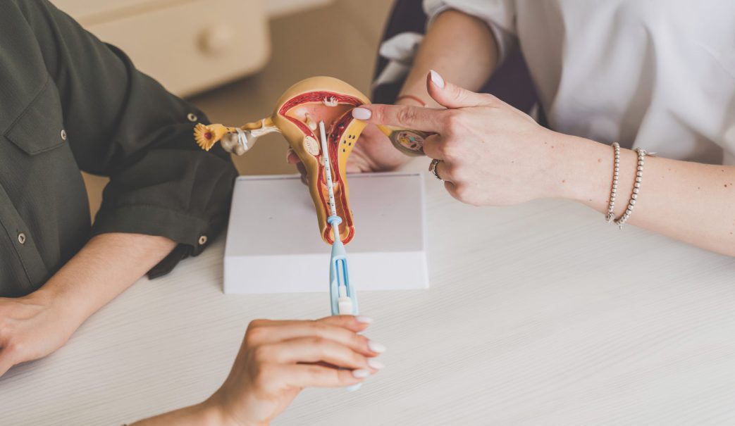 Dispositivo-intrauterino-diu_BLOGHLA