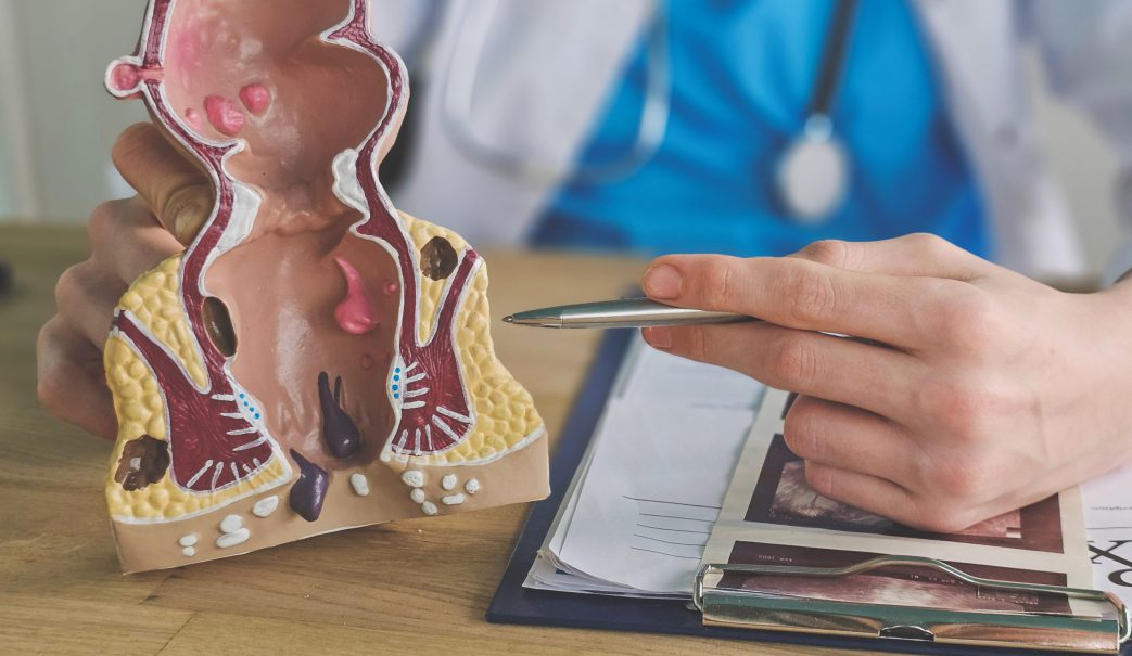 proctologia-minimamente-invasiva-BLOGHLA