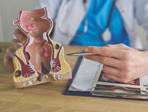 proctologia-minimamente-invasiva-BLOGHLA